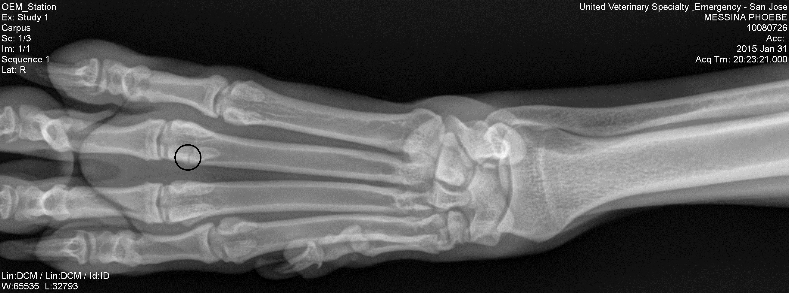 Right Foot X Ray
