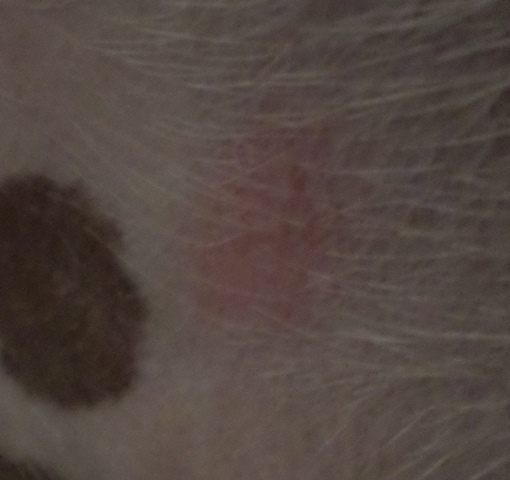 Another welt after skin scraping